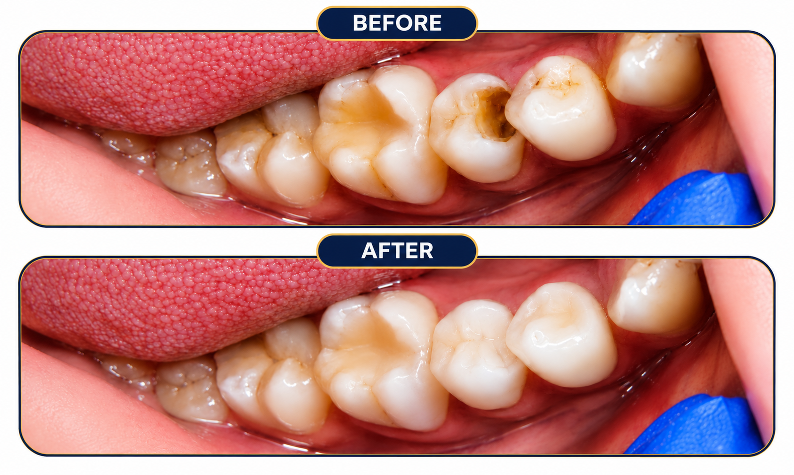 Dental-Before-After-01.png