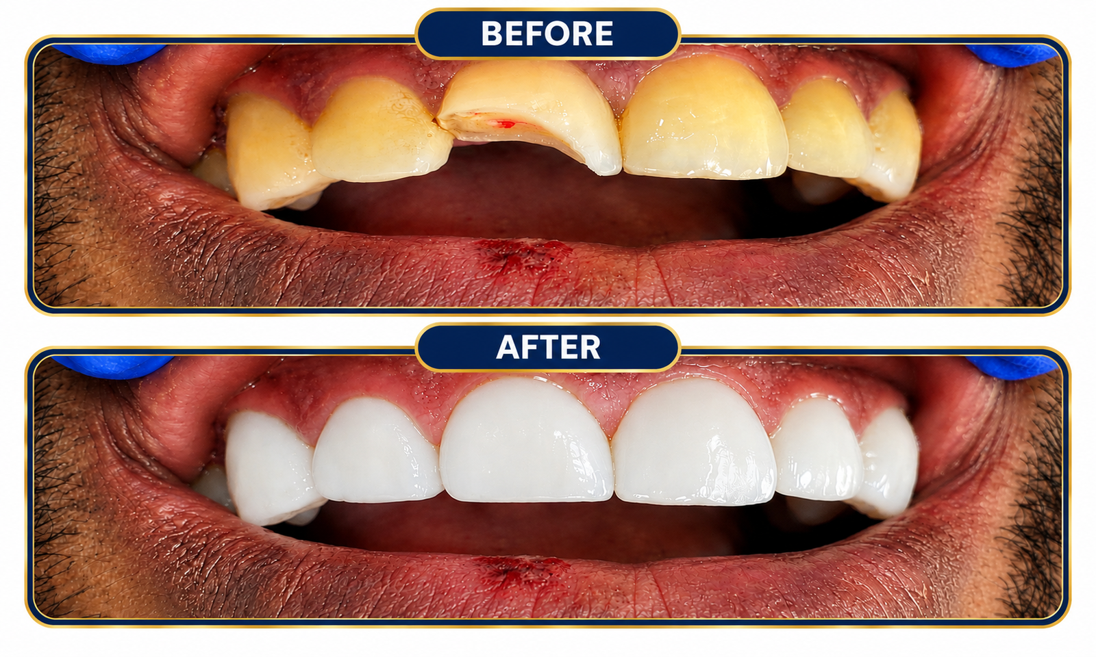 Dental-Before-After-02.png