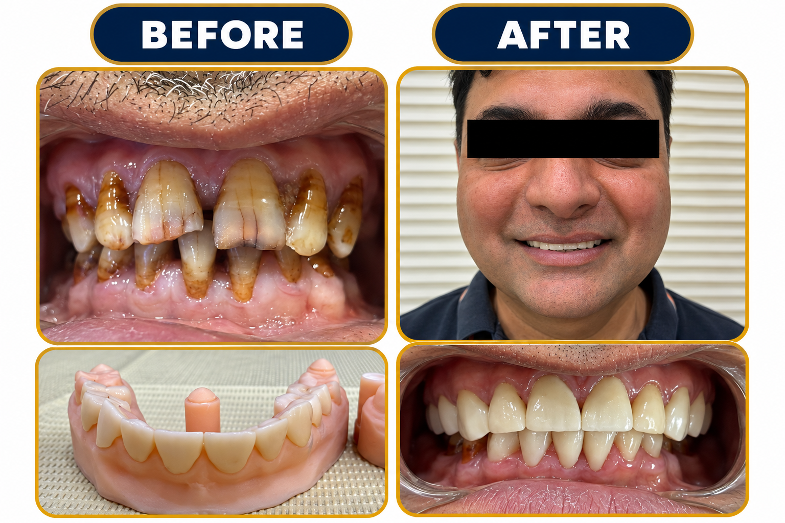 Dental-Before-After-05.png