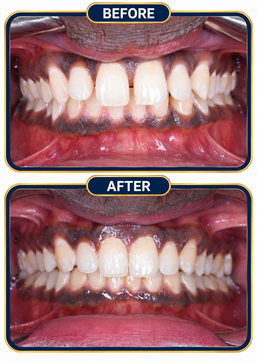 Dental-Before-After-06.png